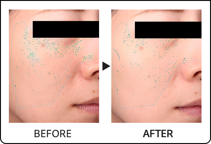 BEFORE AFTER